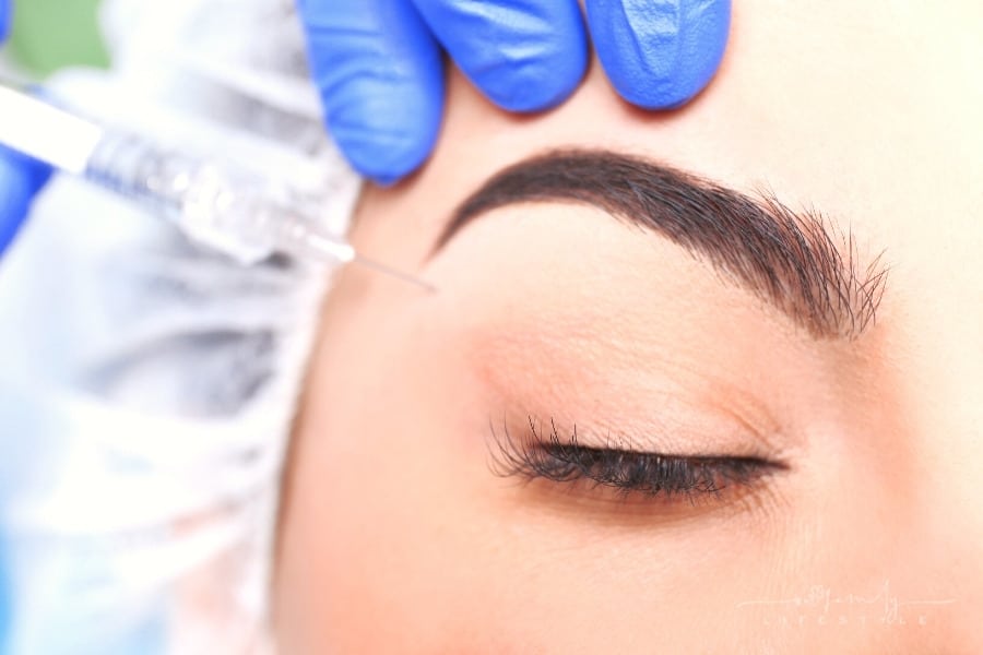 4 Important Questions and Answers About Most Common Cosmetic Procedures